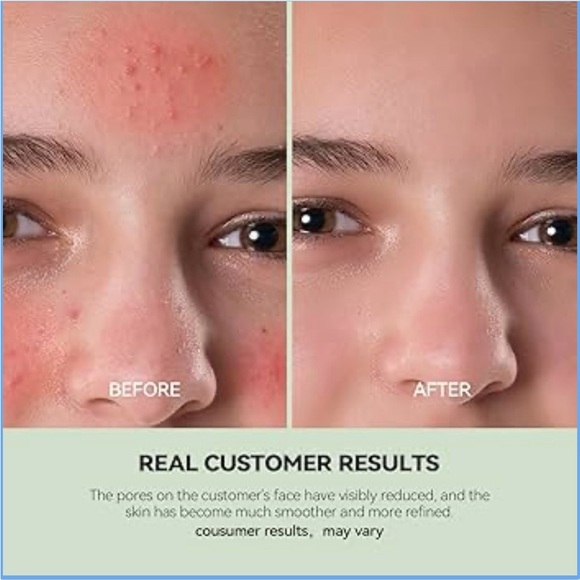 WNP Dual Cleansing Clay Mask - Green - Picture 4 of 5